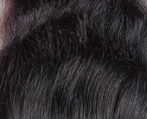 Frontal hair (2)
